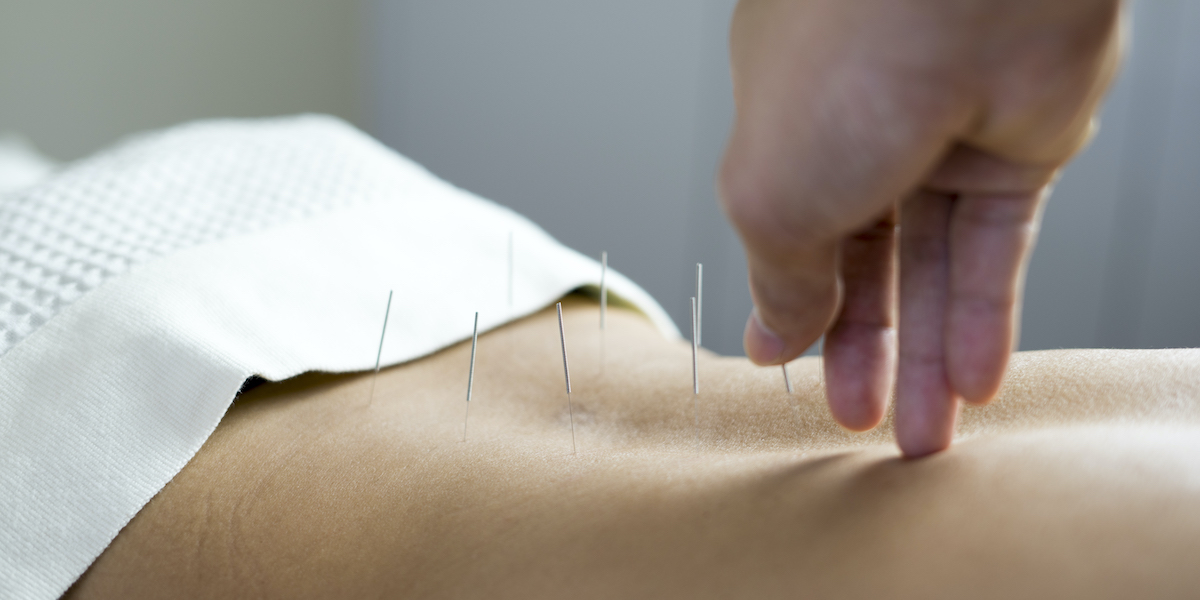 acupuncture Oakridge Physiotherapy Vancouver
